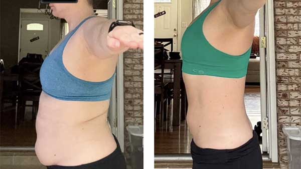 Before and after medical weight loss treatment