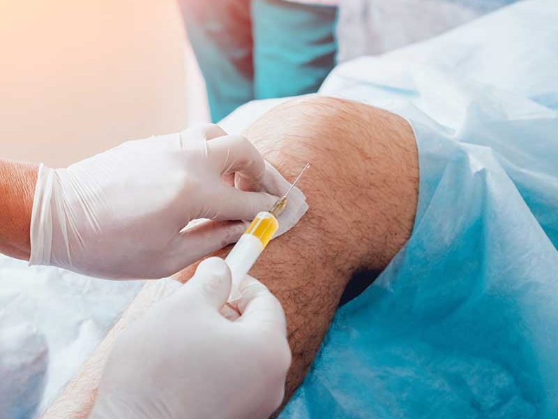 Doctor prepping injection site for platelet rich plasma therapy for the knee