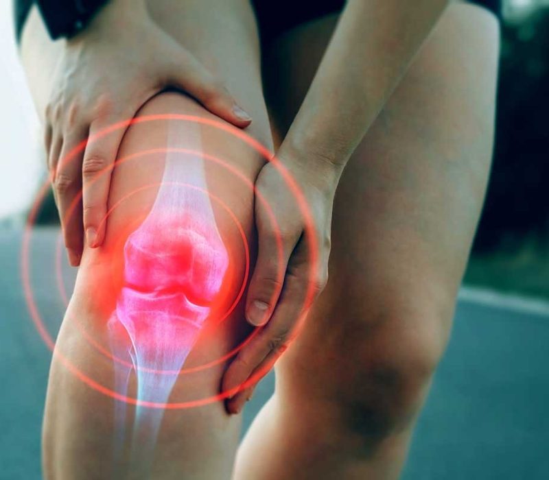 Woman with an injured knee in need of platelet rich plasma therapy